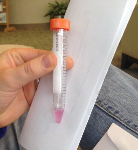 Chris's purple sperm