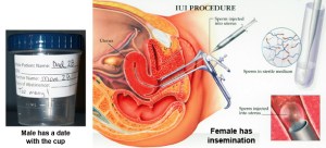The IUI procedure summed up