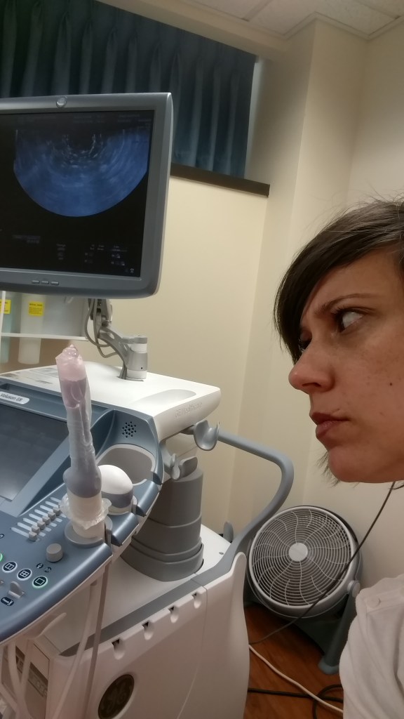 IMG_20170418_083926692